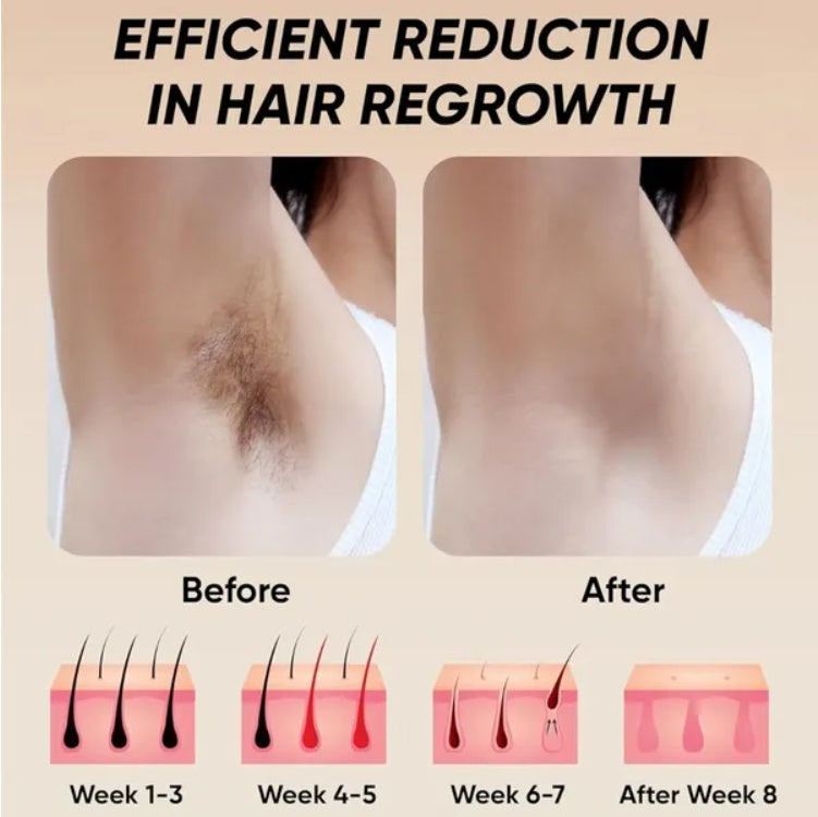 Removelle™ - Flawless Touch-Free Confidence