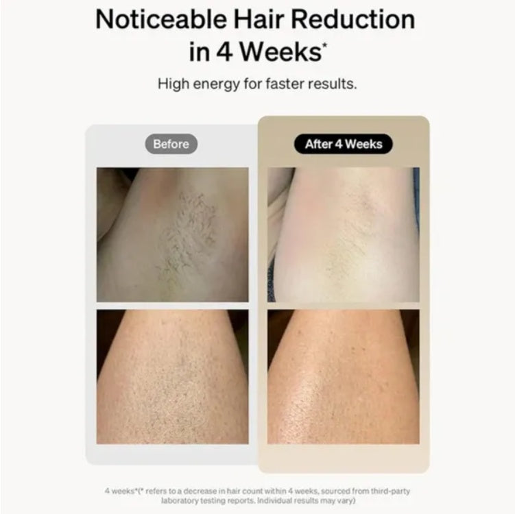 Removelle™ - Flawless Touch-Free Confidence